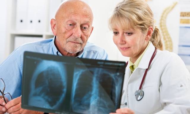 To tylko chrypka i kaszel? Pierwsze objawy raka płuca łatwo zignorować. Sprawdź, po tym rozpoznasz najczęściej występujący nowotwór złośliwy