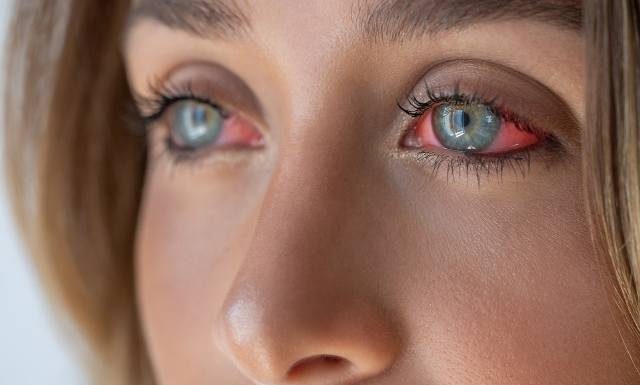 Problemy z oczami skutkiem smogu. Gdy zauważysz takie objawy, mogą być powikłania! Tak możesz chronić wzrok przed zanieczyszczeniami