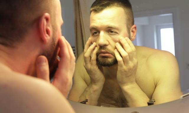 Worki pod oczami nie znikają? Winne niekoniecznie zmęczenie. To może być objaw poważnej choroby. Zbadaj swoje nerki