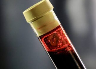 Lepiej wiedzieć, leczyć i żyć normalnie. Test na HIV jest darmowy, anonimowy i dostępny bez skierowania. To warto wiedzieć