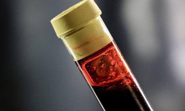 Lepiej wiedzieć, leczyć i żyć normalnie. Test na HIV jest darmowy, anonimowy i dostępny bez skierowania. To warto wiedzieć