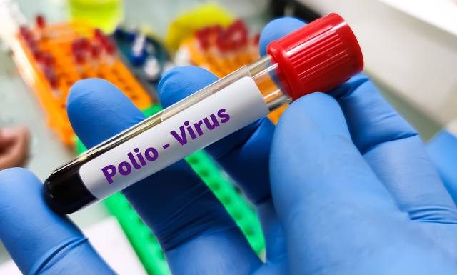 Wykryto rzadki i groźny wirus w Warszawie. Przed zmutowaną wersją wirusa polio ostrzega GIS. Tak można chronić się przed zakażeniem