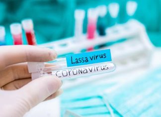 Setki chorych, 22 osoby zmarły. Gorączka Lassa się rozprzestrzenia