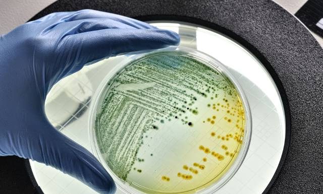 Groźna bakteria E. coli występuje w wodzie i żywności. Tak unikniesz zatrucia i powikłań zakażenia