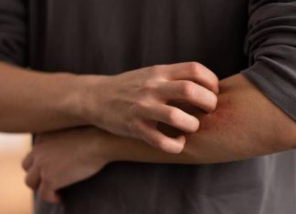 Swędzenie skóry – niewinne podrażnienie czy sygnał poważnych problemów zdrowotnych? Dowiedz się, co może być przyczyną świądu skóry