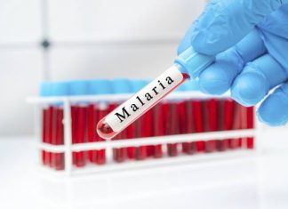 Malaria to choroba zagrażająca życiu. Możesz się nią zarazić podczas egzotycznej podróży. Sprawdź, jakie są objawy malarii