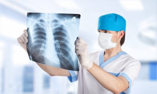 Objawia się nie tylko kaszlem. Gruźlica to nadal realne zagrożenie. Jak ją rozpoznać i leczyć? Zobacz, co trzeba wiedzieć o gruźlicy