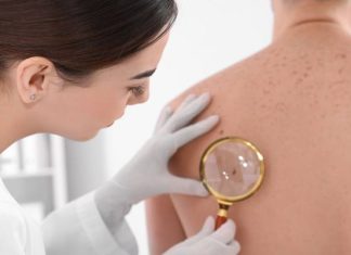 Czerniak, czyli złośliwy nowotwór skóry. Przyczyny, objawy i leczenie. Czerniak a pieprzyk – jak odróżnić?