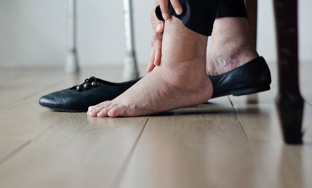 Objawy dny moczanowej możesz łatwo pomylić z przemęczeniem lub innym schorzeniem. Nie ignoruj ich! Mogą być powiązane z podagrą