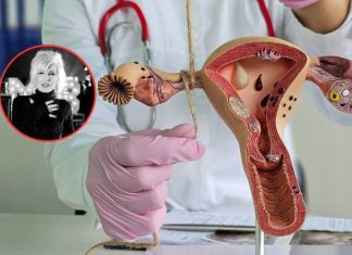 Kora latami żyła z bólem. Diagnoza przyszła za późno. To jeden z najgroźniejszych nowotworów u kobiet