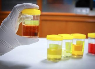 Kolor moczu ma znaczenie. Konkretny odcień może być objawem choroby, na przykład zapalenia pęcherza. O czym świadczy twój kolor moczu?