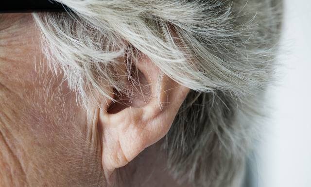 Twoje ucho tak wygląda? To znak, że wkrótce możesz mieć zawał serca. Znak Franka ostrzega przed miażdżycą i udarem