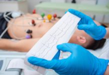 Nowa przyczyna zawału serca odkryta. Naukowcy podważyli dotychczasową wiedzę