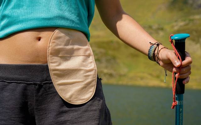 Życie ze stomią. 7 Faktów, które każdy z nas powinien znać