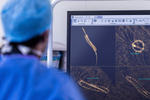 Nowa era diagnostyki serca: GE HealthCare o rozwiązaniach, które zmieniają kardiologię