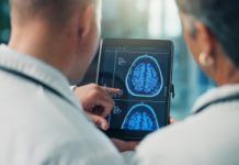 Spowalnia starzenie mózgu nawet o 8 lat. Badacze: zmniejsza ryzyko alzheimera