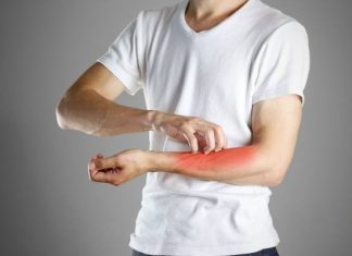 Świerzb ludzki – drogi zakażenia, przyczyny, objawy, diagnostyka i leczenie. Jak można zakazić się świerzbowcem?