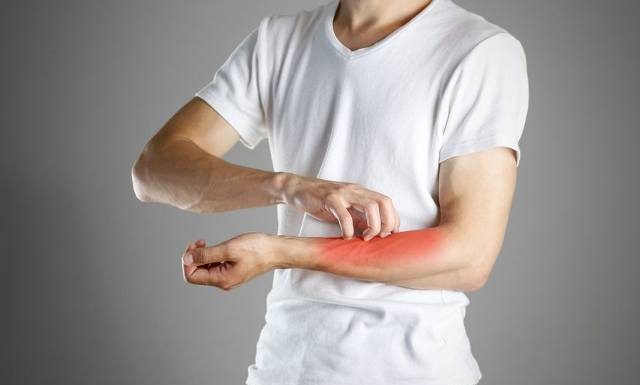 Świerzb ludzki – drogi zakażenia, przyczyny, objawy, diagnostyka i leczenie. Jak można zakazić się świerzbowcem?