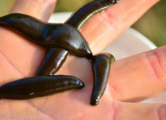 Hirudoterapia – zastosowanie pijawek leczniczych, bezpieczeństwo zabiegu, korzyści i przeciwwskazania