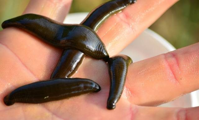 Hirudoterapia – zastosowanie pijawek leczniczych, bezpieczeństwo zabiegu, korzyści i przeciwwskazania