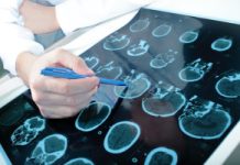 90 tys. udarów rocznie. Ekspertka: bardzo niepokoi powszechny niedobór snu