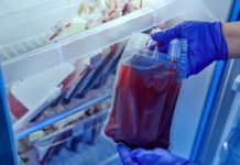 Ta grupa krwi zwiększa ryzyko udaru. Naukowcy wyjaśnili przyczynę