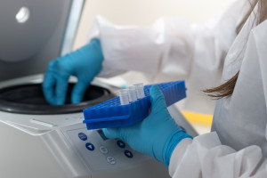 Koniec kolonoskopii? Naukowcy chcą wykrywać raka jelita z bakterii