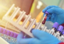 Cholesterol to za mało. Ten wskaźnik lepiej przewiduje zawał i udar