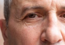 Skraca życie o 10 lat. Pierwszy objaw widać na nosie