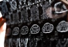 Odmładza i regeneruje wątrobę. Klucz, by cofnąć zniszczenia