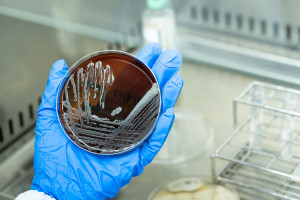 Prof. Wojciech Bik: Mikrobiota może stać się jednym z elementów nowoczesnej terapii choroby otyłościowej