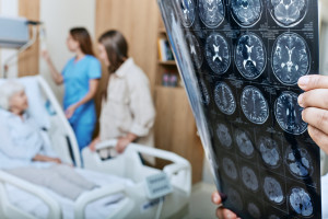 600 tys. Polaków żyje z otępieniem. Zbyt późna diagnoza zamyka drogę