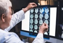 Glejak: neurochirurg o długości życia i sposobach leczenia
