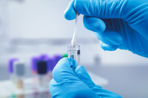 Dlaczego rak wybiera tylko niektórych? Zaskakujące wyniki badań wątroby