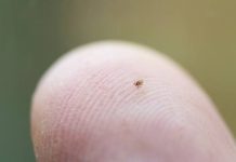 Nowy pieprzyk? Ostrożnie! To może być nimfa kleszcza. Zobacz, dlaczego nimfy kleszcza są groźniejsze od dorosłych kleszczy