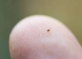 Nowy pieprzyk? Ostrożnie! To może być nimfa kleszcza. Zobacz, dlaczego nimfy kleszcza są groźniejsze od dorosłych kleszczy